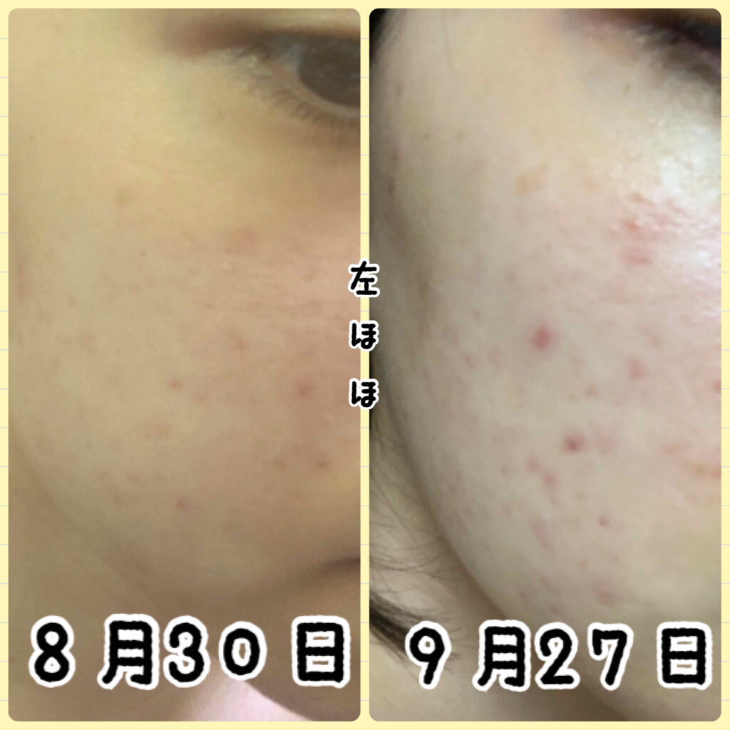 新ビオフェルミンS錠 /ビオフェルミン/健康サプリメントを使ったクチコミ（2枚目）