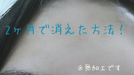 フタアミンhiクリーム/ムサシノ製薬/ハンドクリームを使ったクチコミ(2枚目)