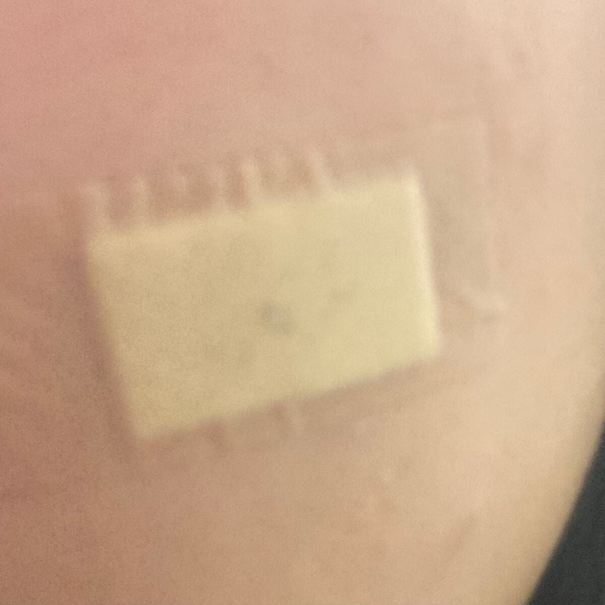 テラ・コートリル 軟膏(医薬品)/ジョンソン・エンド・ジョンソン/その他を使ったクチコミ(3枚目)