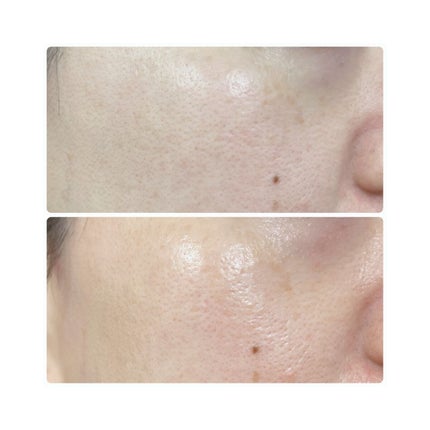 オイルインローション/ONE STONE TWO BIRDS/化粧水を使ったクチコミ(6枚目)