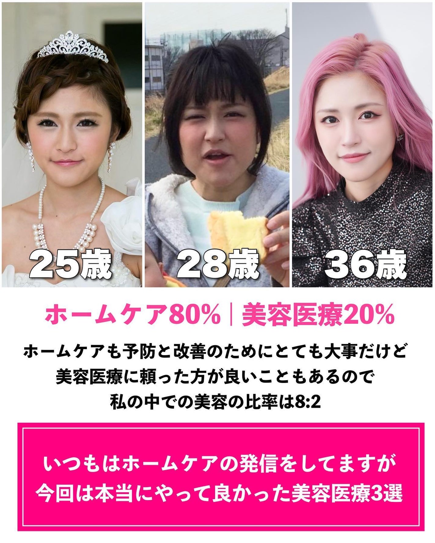 とみりー on LIPS 「36歳がやってよかった美容医療まとめ✨◆───--- - -..」(2枚目)