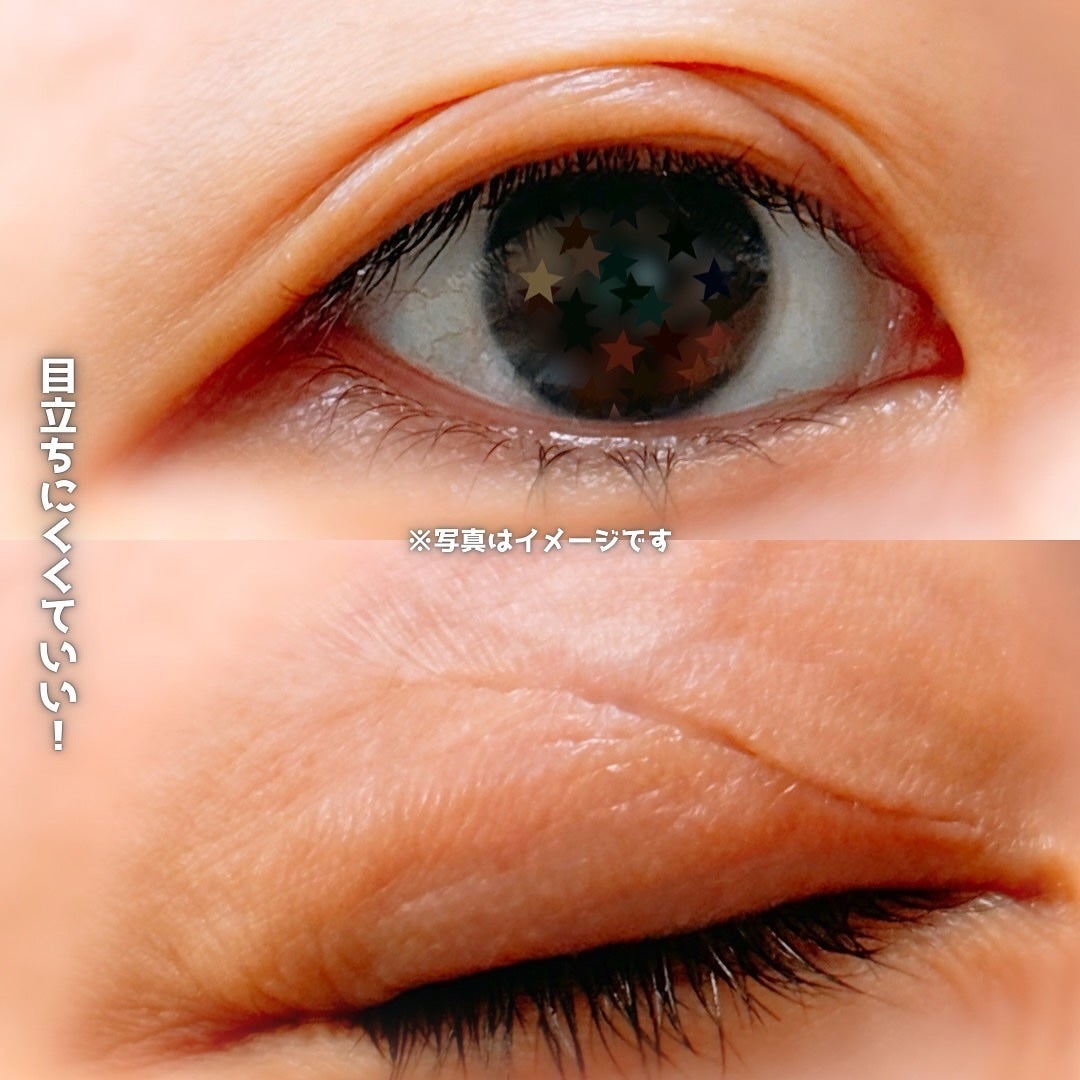 メザイク クリップ カッター ファイバー専用カッター/メザイク/二重まぶた用アイテムを使ったクチコミ(7枚目)