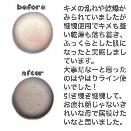 リードルショット300/VT/美容液を使ったクチコミ(5枚目)