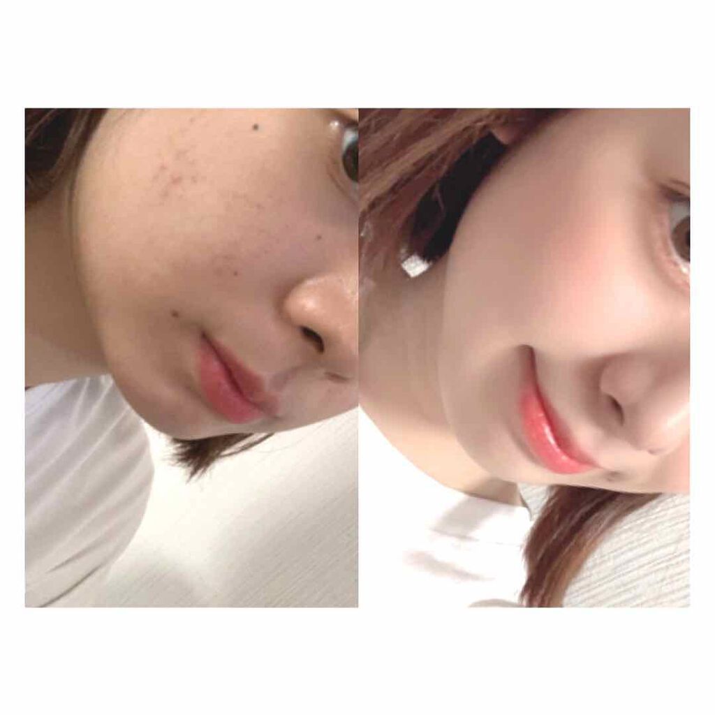 カバーパーフェクション チップコンシーラー/the SAEM/リキッドコンシーラーを使ったクチコミ（1枚目）