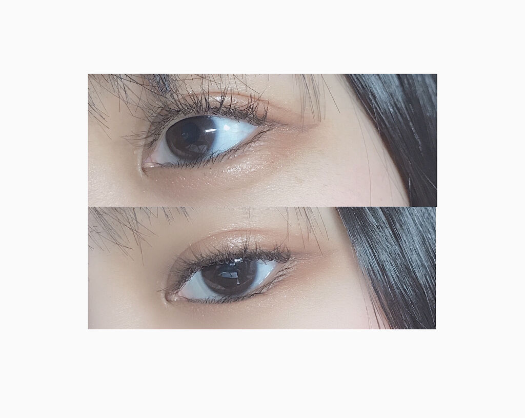 二重整形/その他を使ったクチコミ（2枚目）