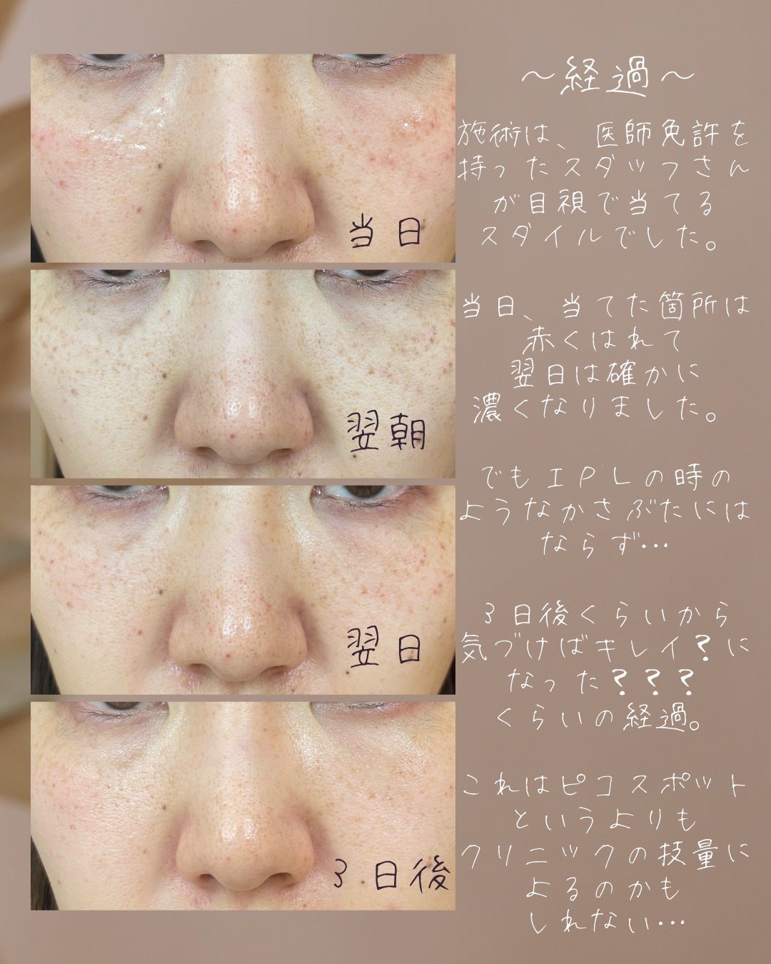 ããðª on LIPS ããã³ã¹ãããã®èšé²âïžðããããããã³ã¬ãŒã¶ãŒããšã¯ãã³ç§ïŒ1..ãïŒ4æç®ïŒ