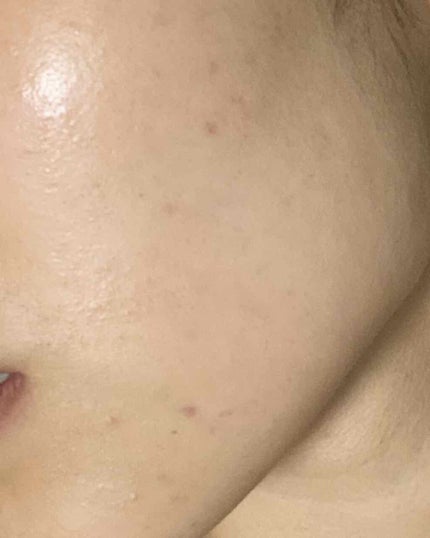 アルビオン 薬用スキンコンディショナー エッセンシャル/ALBION/化粧水を使ったクチコミ(1枚目)