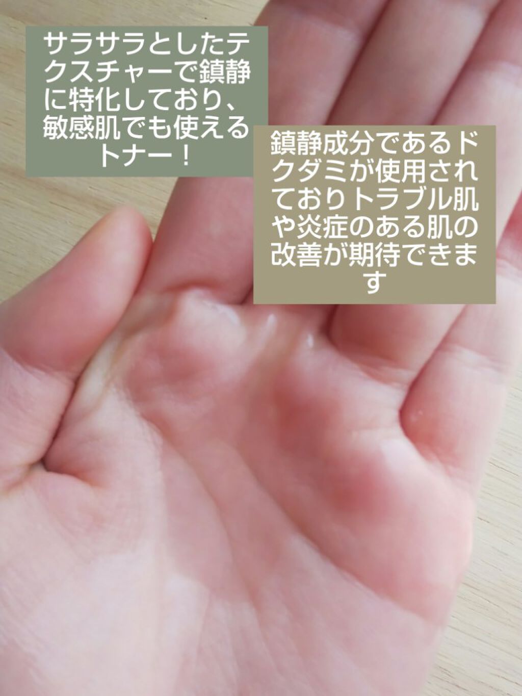 ãã¯ãã 77 ã¹ãŒãžã³ã°ãããŒ/Anua/åç²§æ°Žã䜿ã£ãã¯ãã³ãïŒ2æç®ïŒ