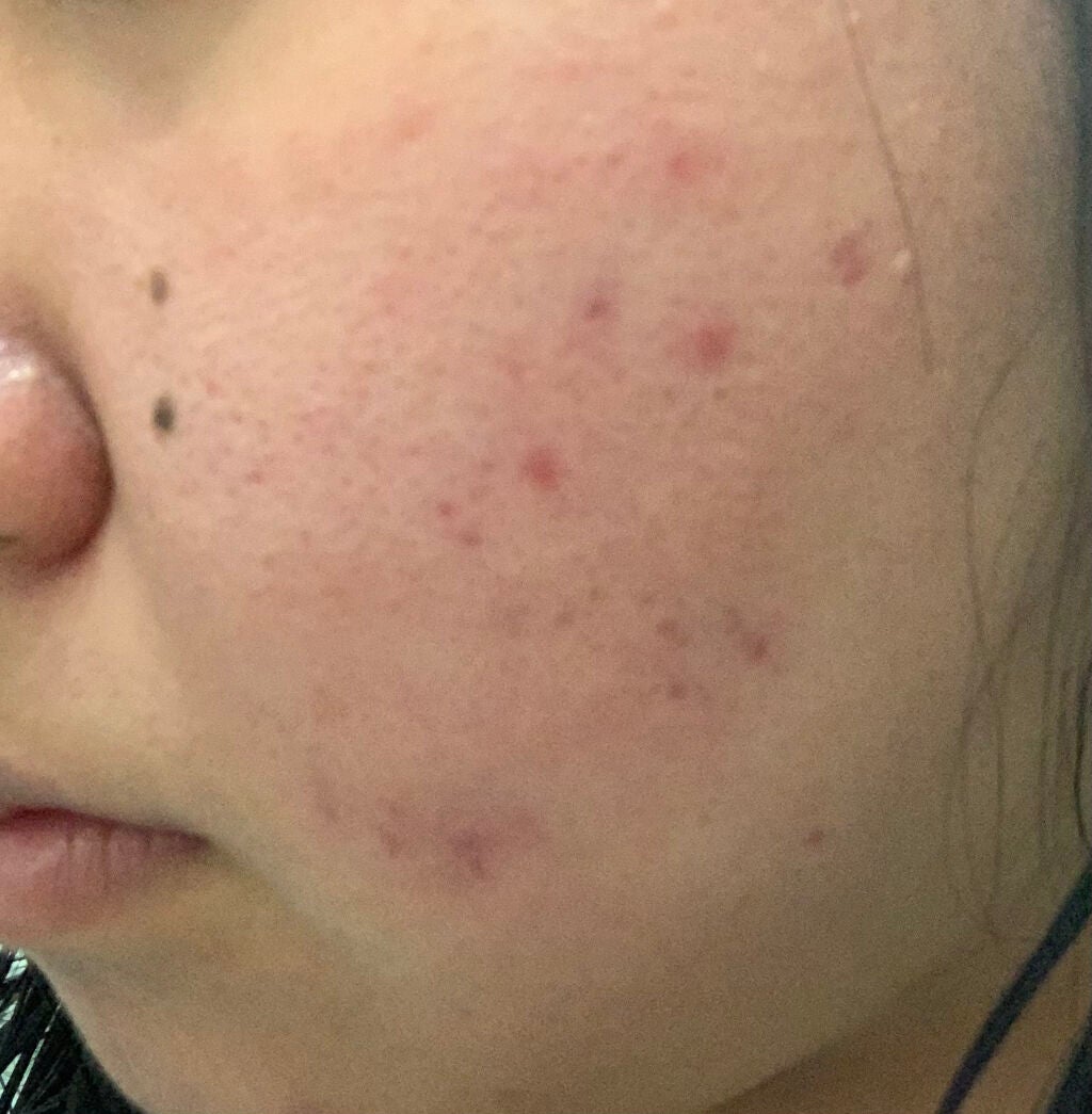 ハトムギ保湿ジェル(ナチュリエ スキンコンディショニングジェル)/ナチュリエ/美容液を使ったクチコミ(2枚目)