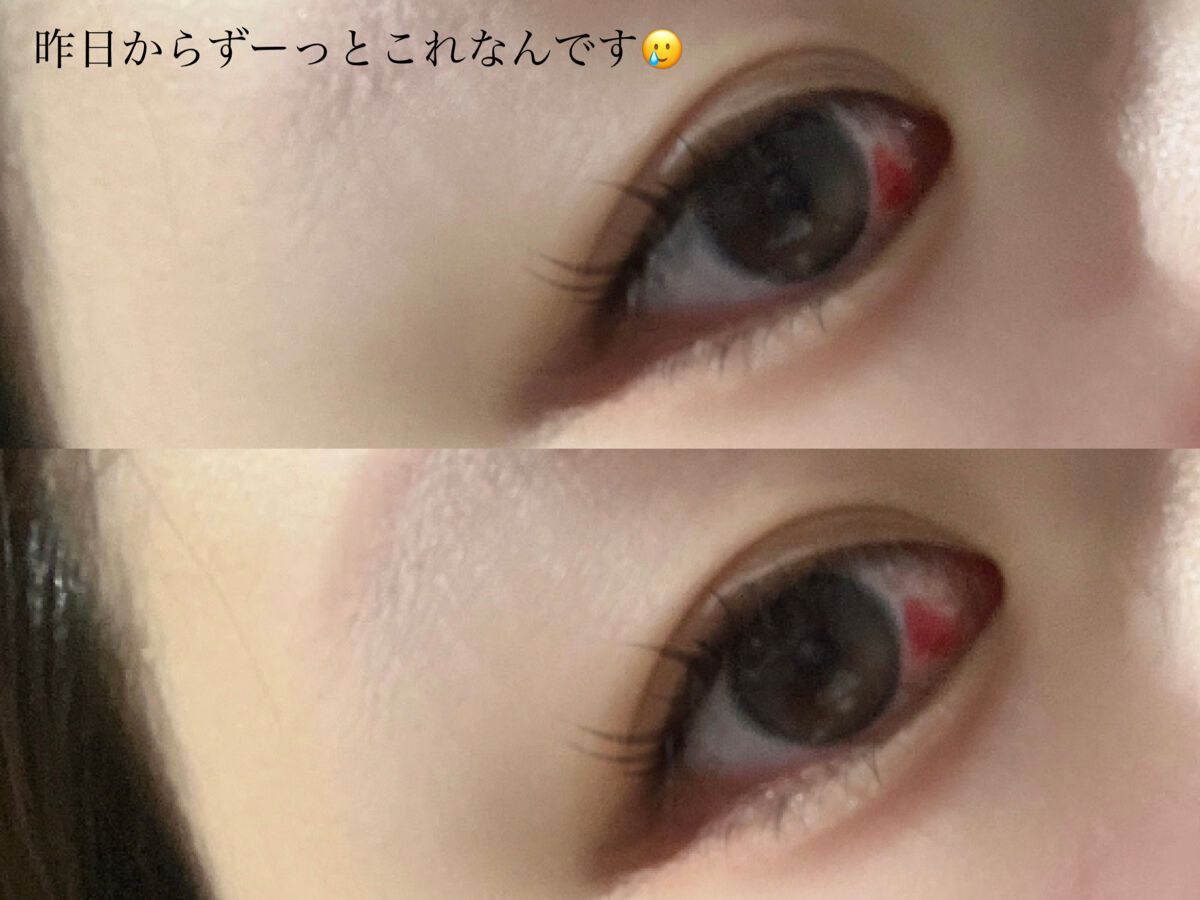 エーオーセプト クリアケア/エーオーセプト クリアケア/その他を使ったクチコミ(2枚目)