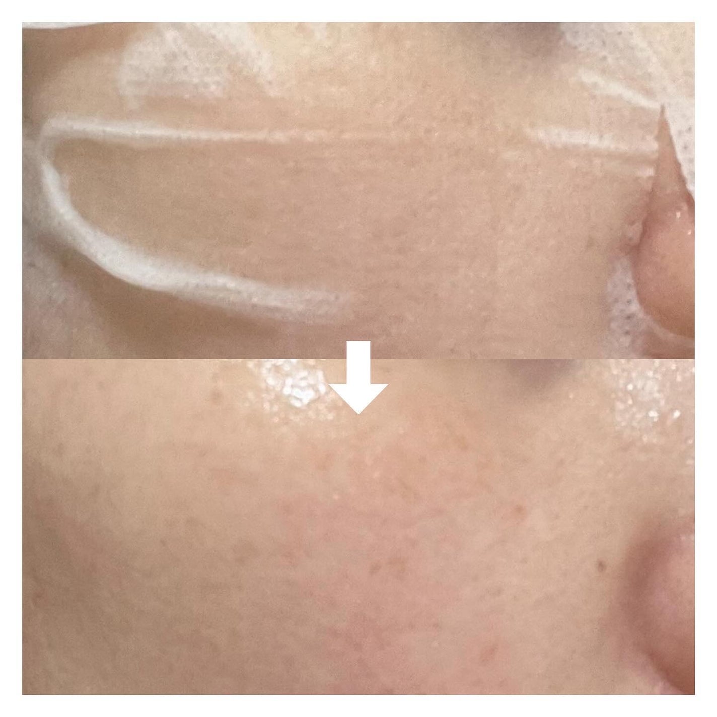 ビタペアC集中美容液シートマスク/ネイチャーリパブリック/シートマスク・パックを使ったクチコミ(7枚目)