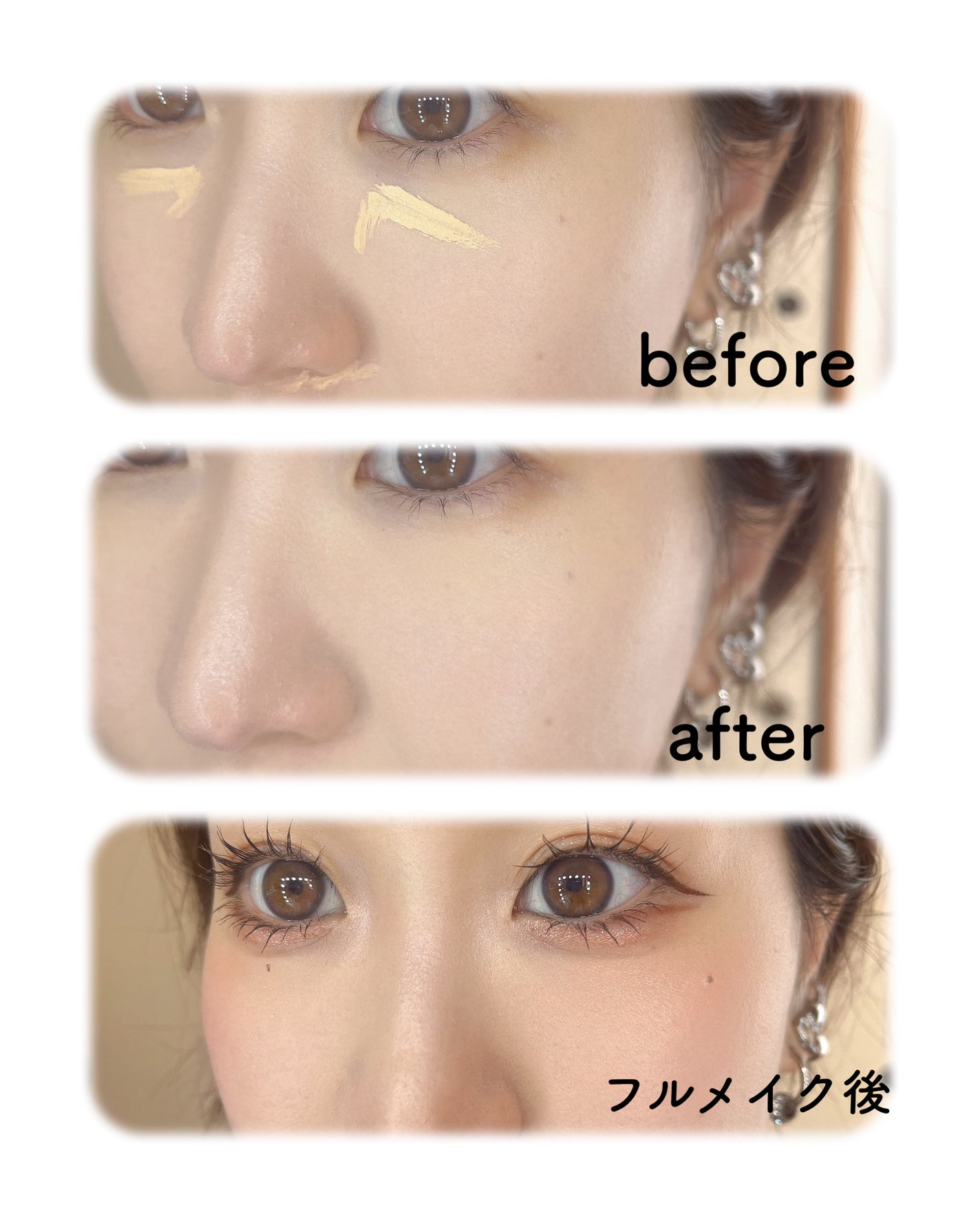 ダーマシンコンシーラー/23years old/リキッドコンシーラーを使ったクチコミ(3枚目)