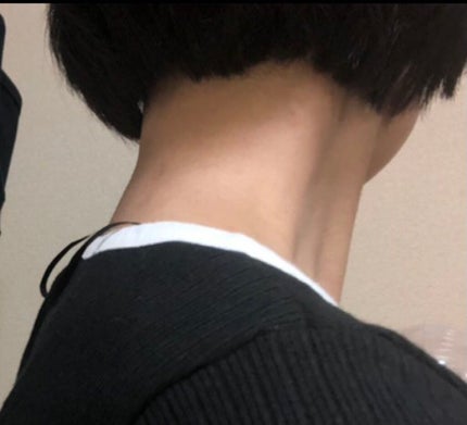 colorful_perfume_7xjs on LIPS 「約2年間背中・うなじニキビと向き合ってきました。〈私の背中・う..」(8枚目)