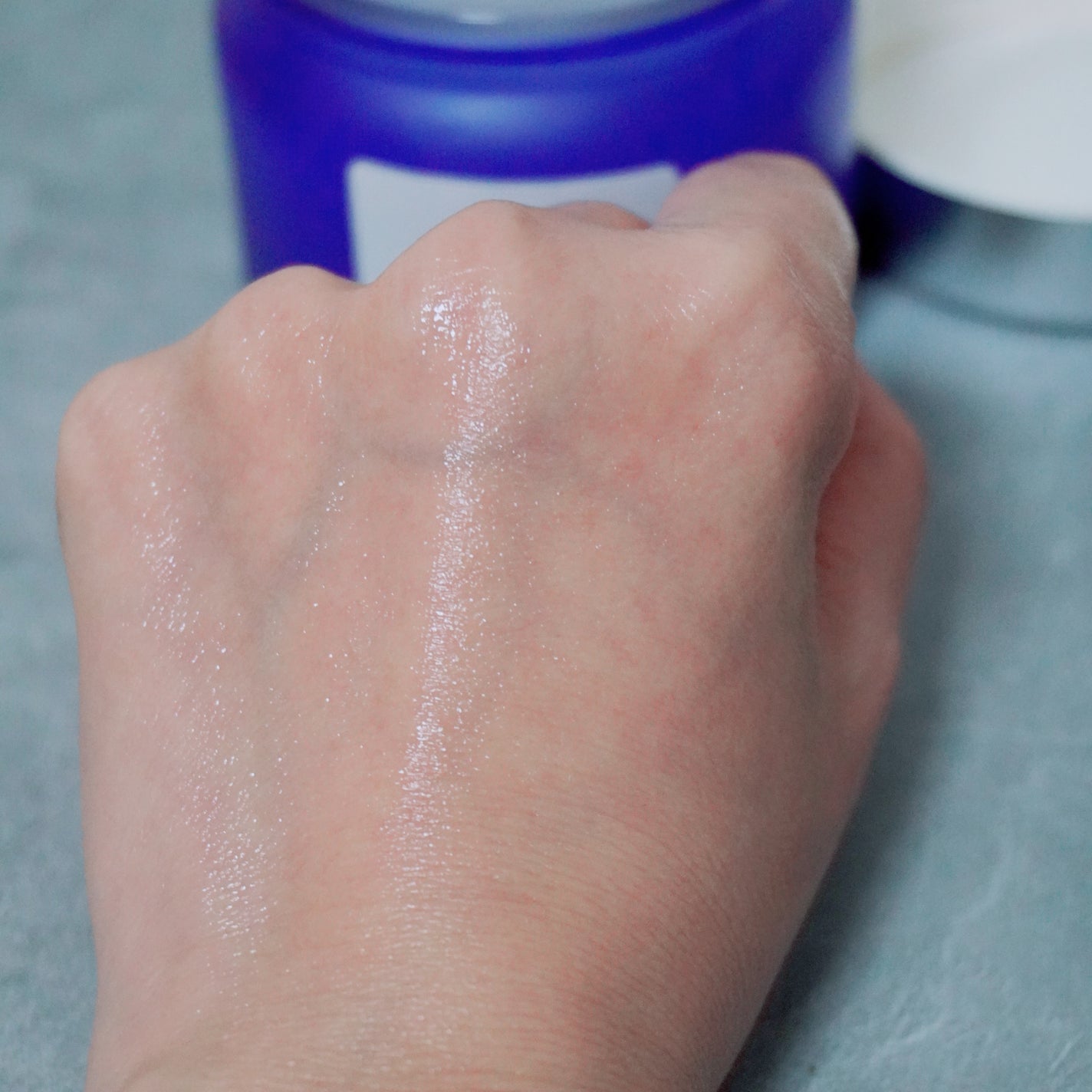 タカミスキンピールボディ/タカミ/ボディローションを使ったクチコミ(6枚目)