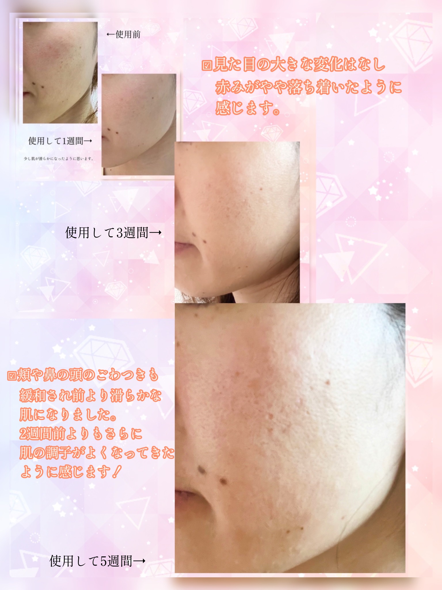 ビモラコスメ VC/BimoRa/美容液を使ったクチコミ（2枚目）