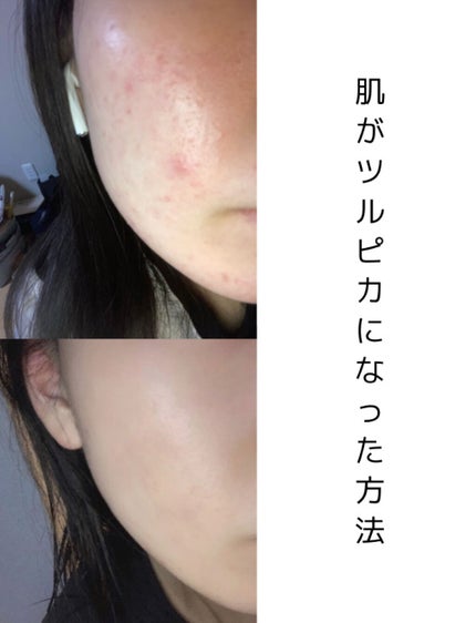 化粧水・敏感肌用・高保湿タイプ/無印良品/化粧水を使ったクチコミ(1枚目)