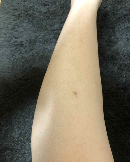 脱毛クリーム MOOMO/自然化粧品研究所/除毛クリームを使ったクチコミ(1枚目)