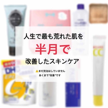 ⚠️3枚目に本当に汚い肌が載っています。苦手な方はご注意を




こんにちは、kotomiです


大学受験まで3ヶ月を切りました。
受験を1度でもしたことがある方、ない方でも想像はつくと思います。
