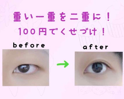 のび〜る アイテープ 両面テープタイプ/DAISO/二重まぶた用アイテムを使ったクチコミ(1枚目)