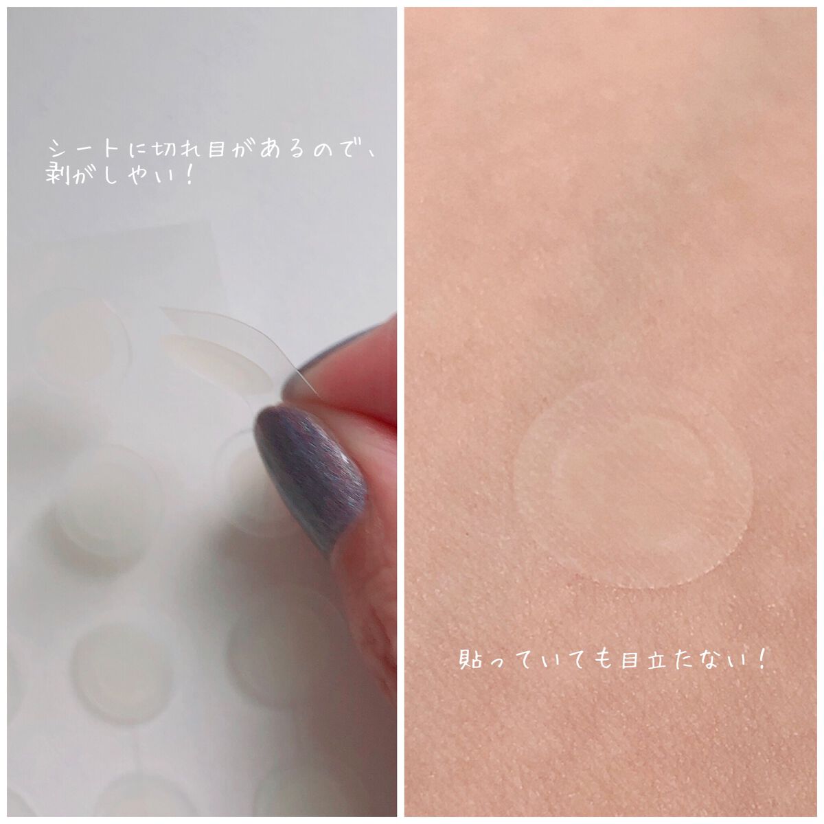 プロCICA クリアスポットパッチ/VT/その他スキンケアを使ったクチコミ(3枚目)