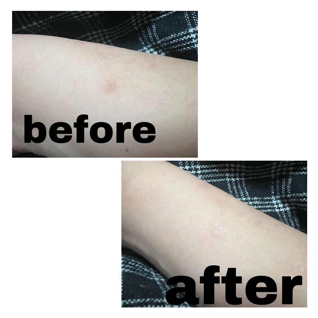 えり on LIPS 「CLIOkillcoverAiryfitコンシーラー2-BPカ..」(3枚目)