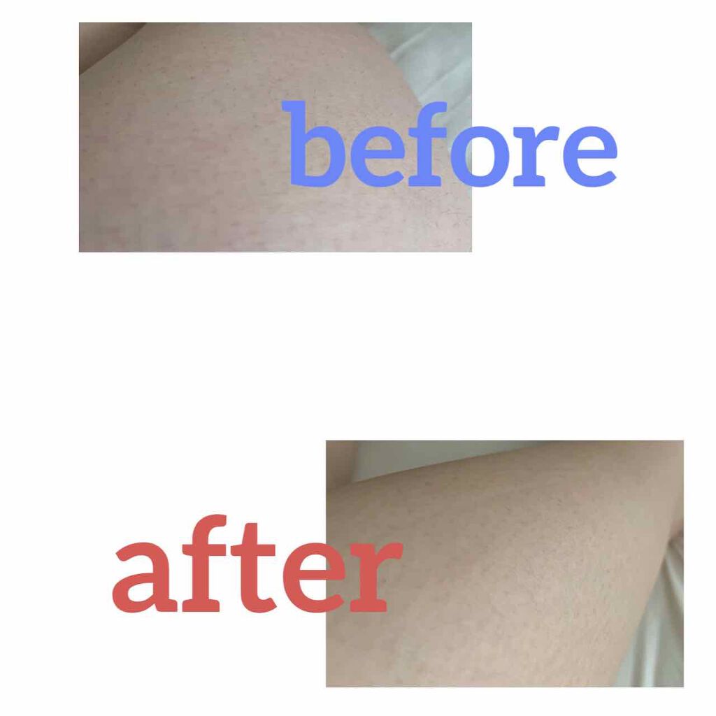 bi-hada ompa T ホルダー替刃２個付/貝印/シェーバーを使ったクチコミ（3枚目）