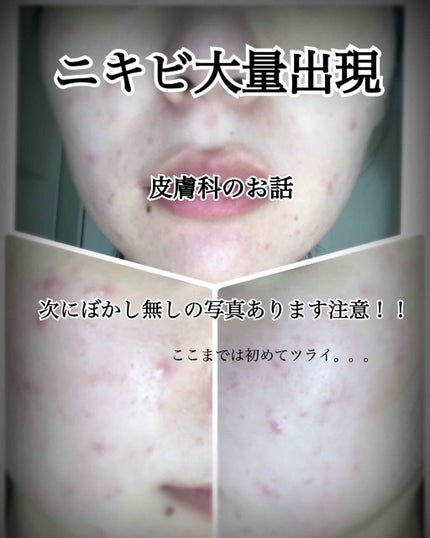 化粧水・敏感肌用・高保湿タイプ/無印良品/化粧水を使ったクチコミ(1枚目)