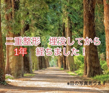 こはく on LIPS 「二重整形　埋没をしてから1年が経ったので記録用に投稿します！そ..」（1枚目）