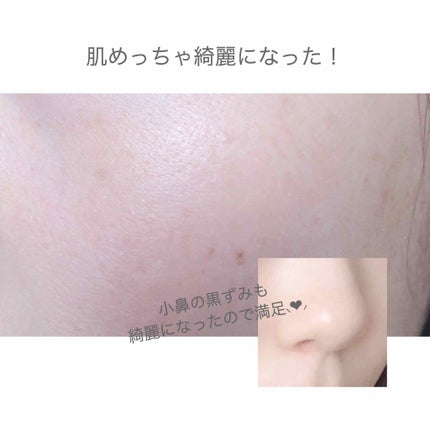 サンタマルシェ ディープクレンジング/サンタマルシェ/クレンジングジェルを使ったクチコミ(3枚目)