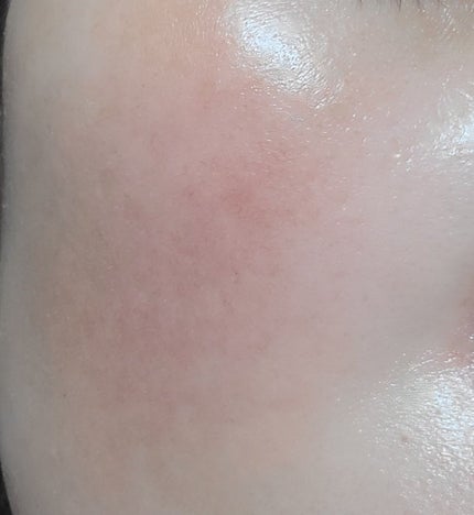 レチノール スーパーバウンス セラム/IOPE/美容液を使ったクチコミ(5枚目)