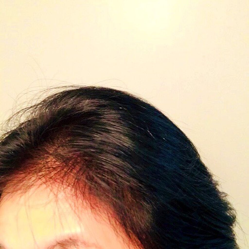 育毛スプレー ボリュームケア/セグレタ/頭皮ローションを使ったクチコミ(9枚目)