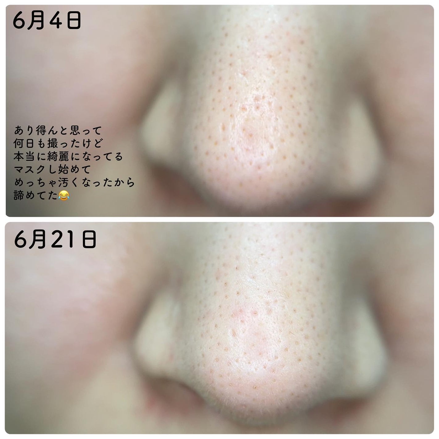 リードルショット300/VT/美容液を使ったクチコミ(7枚目)