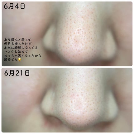 リードルショット300/VT/美容液を使ったクチコミ(7枚目)