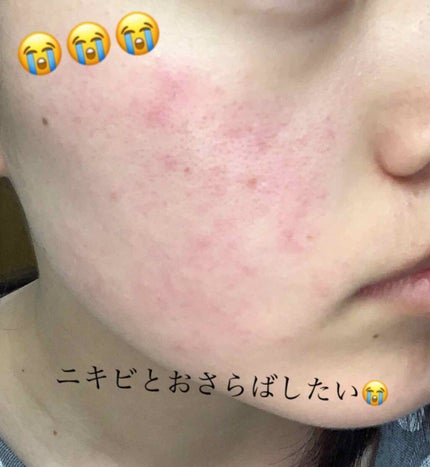 ハトムギ化粧水(ナチュリエ スキンコンディショナー R )/ナチュリエ/化粧水を使ったクチコミ(1枚目)