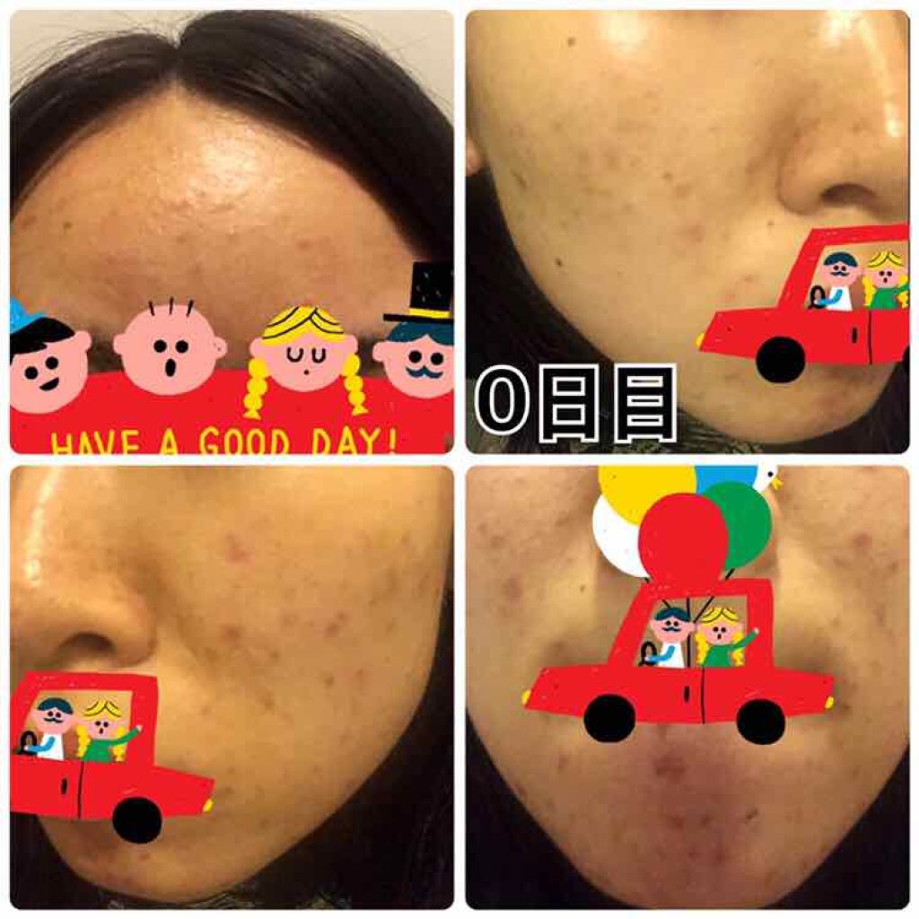 艶肌ドロップ/ラッシュ/美容液を使ったクチコミ(2枚目)