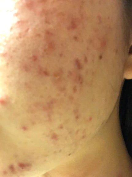 を使ったクチコミ(3枚目)