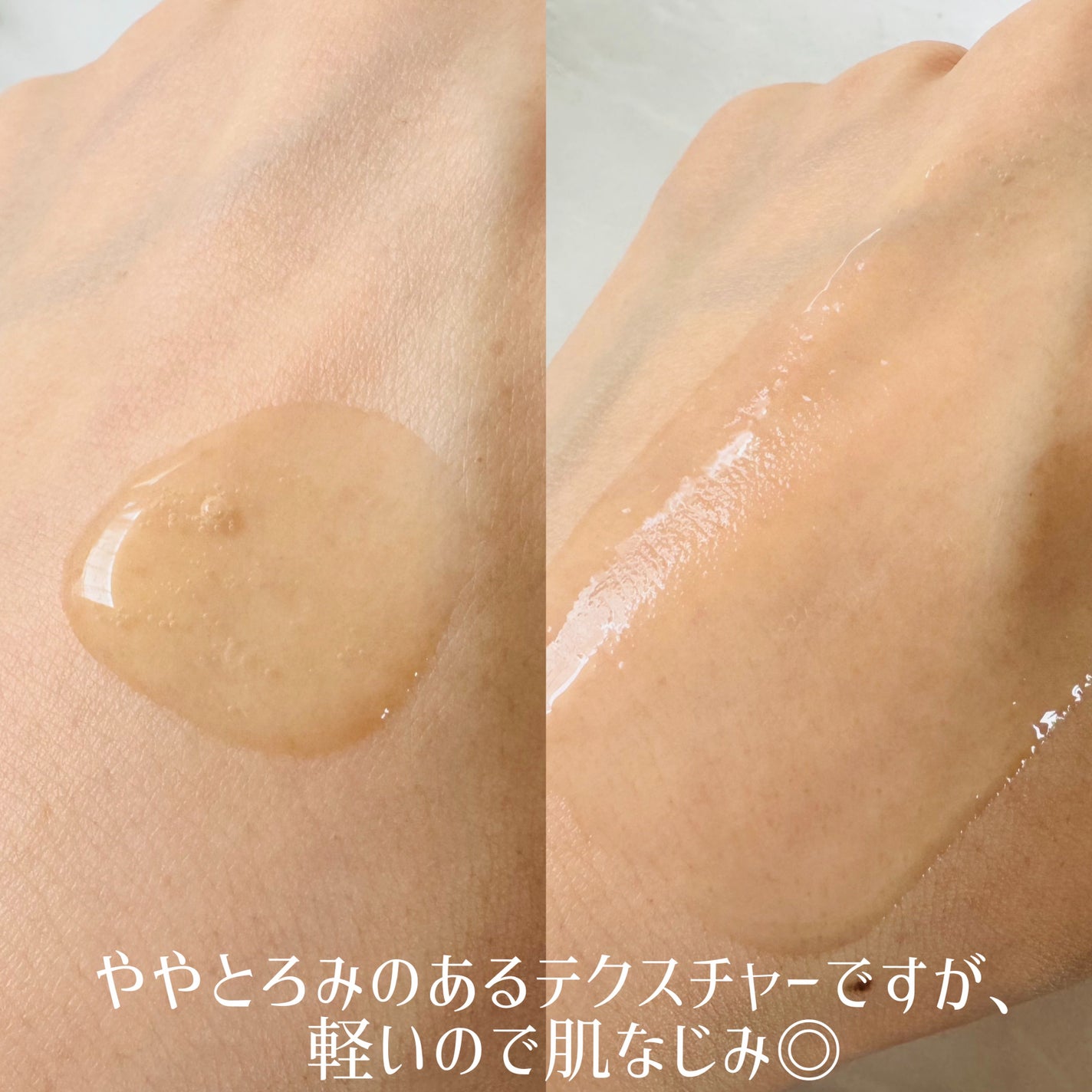 ヴィーガンナイアシンアミドリカバリーセラム/SKIN&LAB/美容液を使ったクチコミ(3枚目)