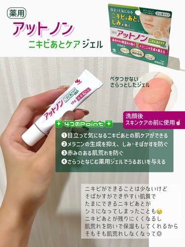 ❇️アットノン
     ニキビあとケアジェル

スキンケアの前に使用する薬用ジェル。
さらさらでベタつかずスキンケアの邪魔をしないのがいい👌🏻

シミ・そばかすや赤みのある肌荒れを防いで保湿もしてくれ