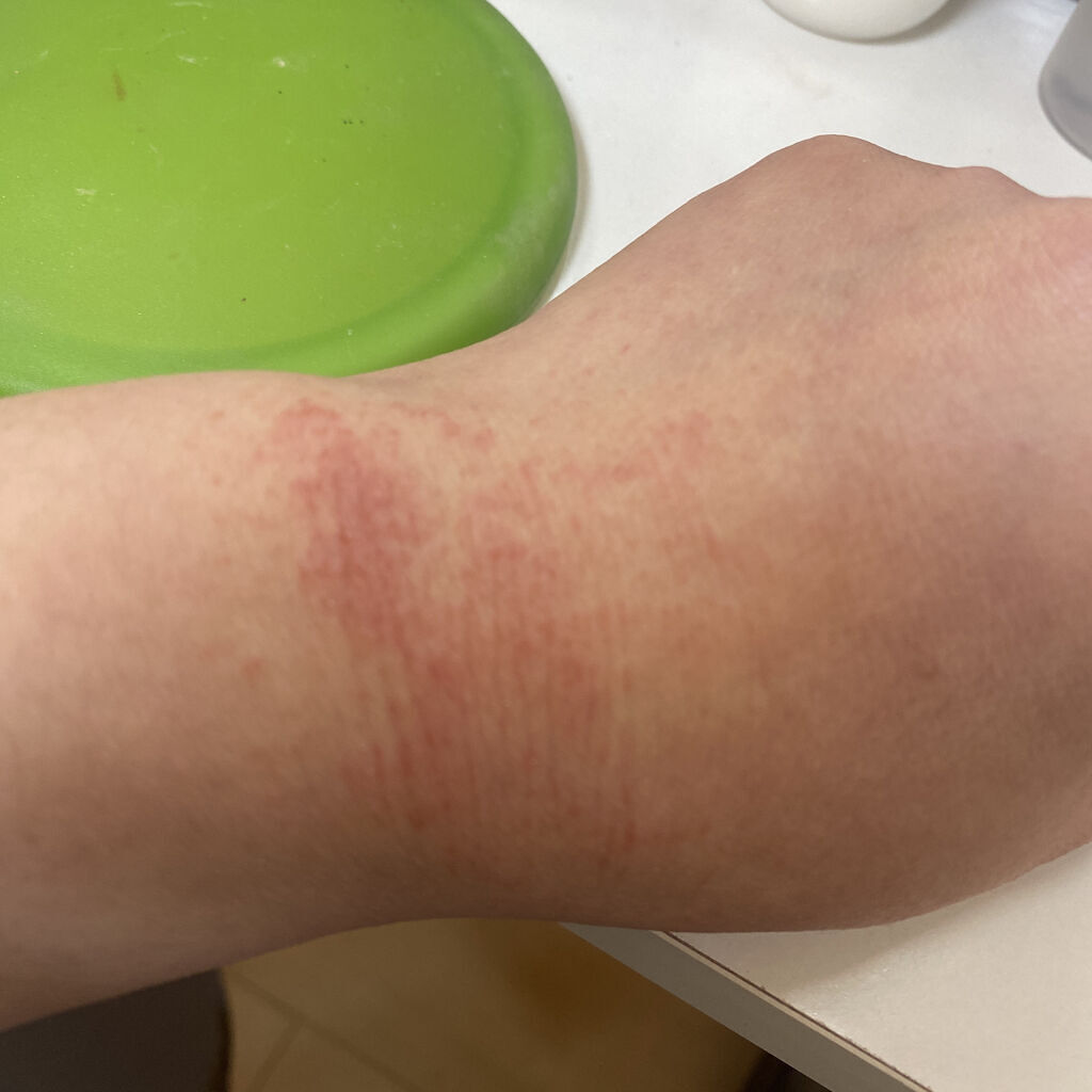 レチノールA 1% アドバンスドリバイタリゼーションクリーム/Life-flo/フェイスクリームを使ったクチコミ（3枚目）