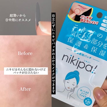 金冠堂 極薄透明パッチ nikipa!のクチコミ「💬 ＼0.05mmのニキビパッチ／


────────────


金冠堂　nikipa!
.....」（3枚目）