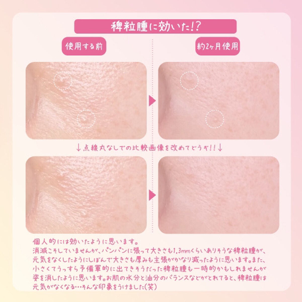 コンディションプレローション/Manier/化粧水を使ったクチコミ(3枚目)