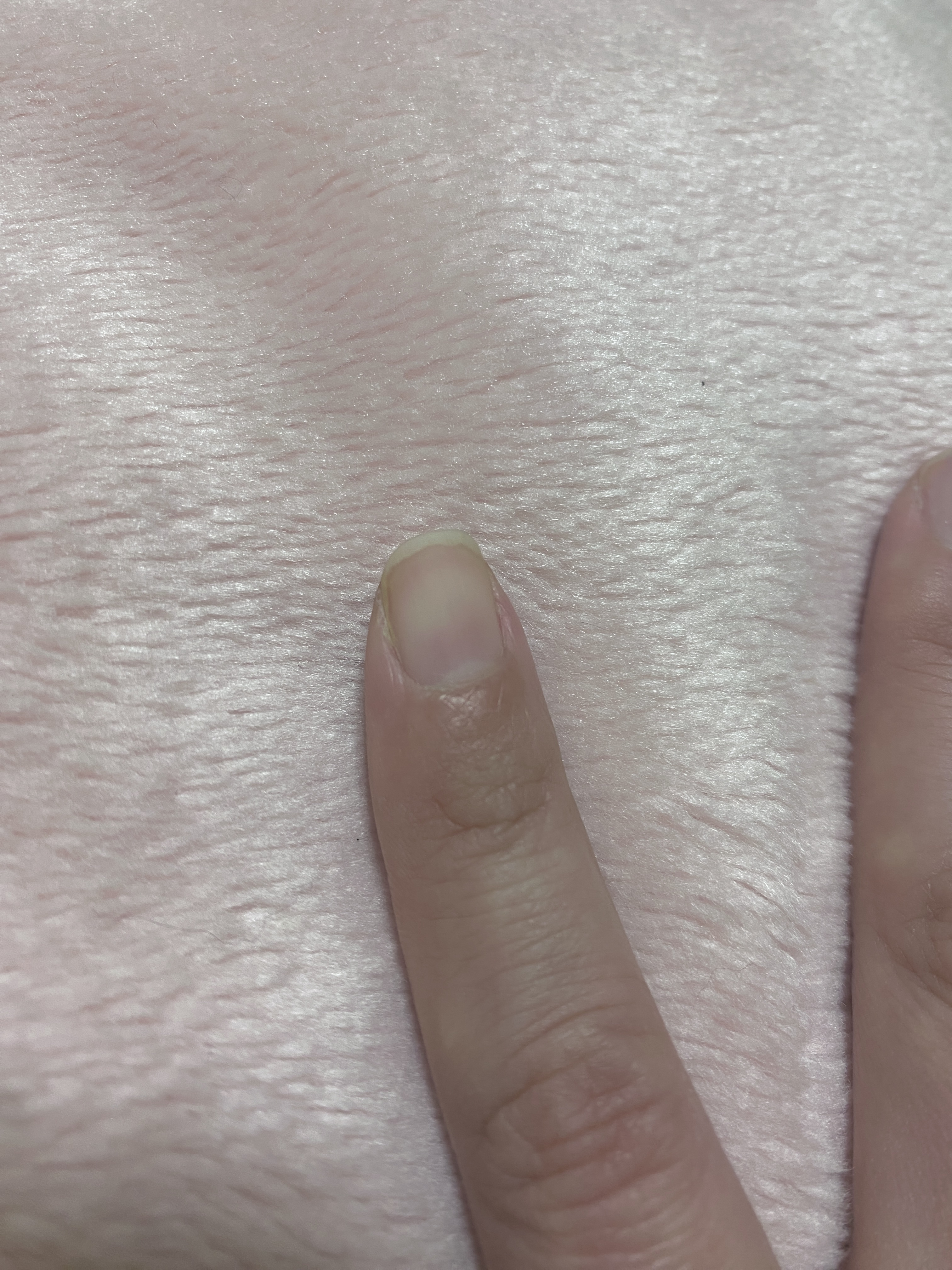 マットトップコート/ちふれ/ネイルトップコートを使ったクチコミ（2枚目）