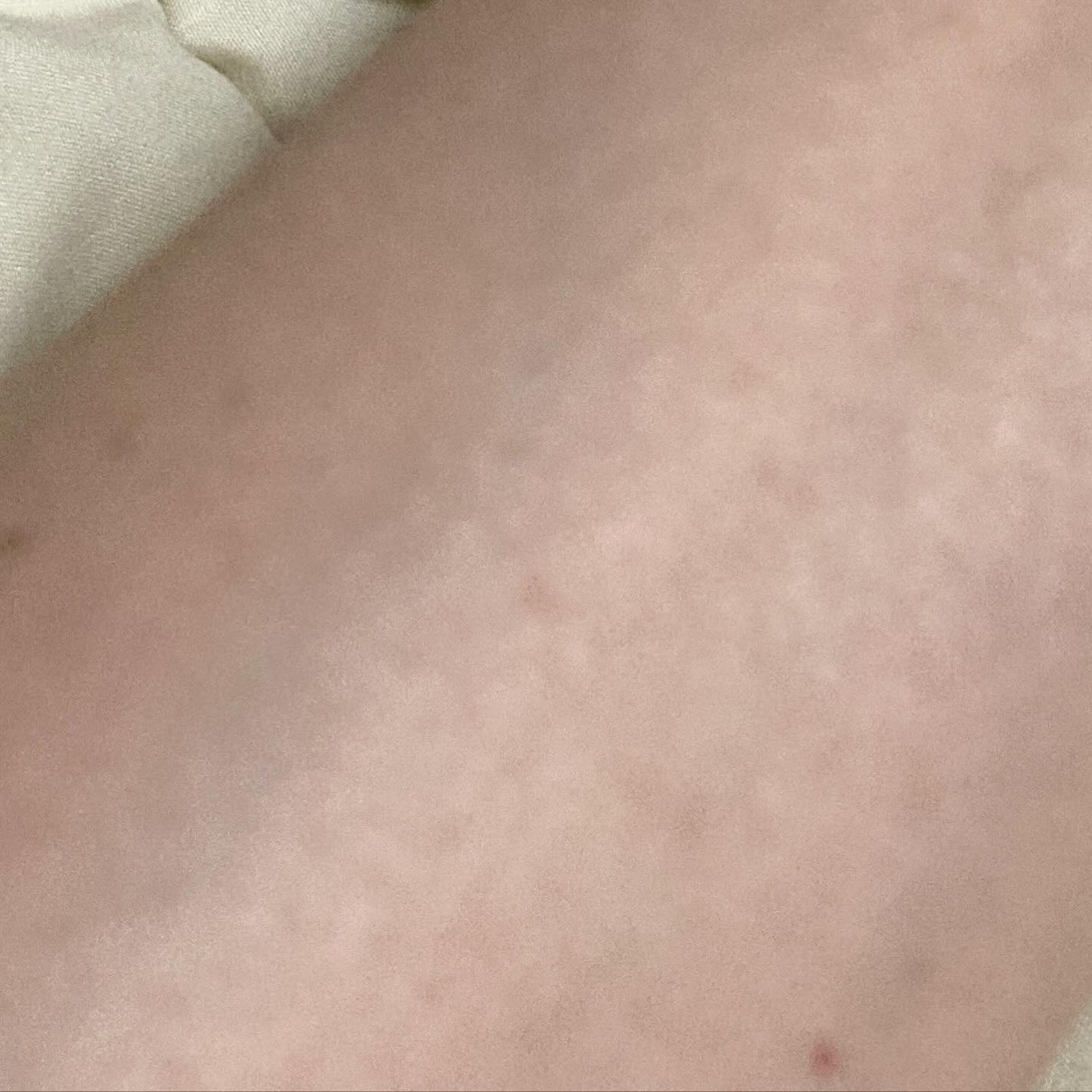 バブルエッセンス/ヒューマニズム/美容液を使ったクチコミ(5枚目)