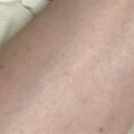 バブルエッセンス/ヒューマニズム/美容液を使ったクチコミ(5枚目)