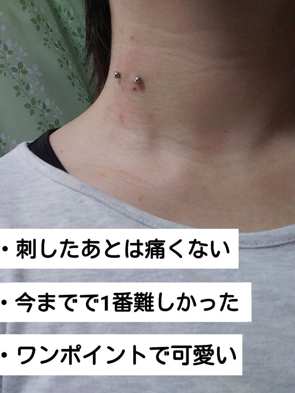 オロナインＨ軟膏 (医薬品)/オロナイン/その他を使ったクチコミ（2枚目）