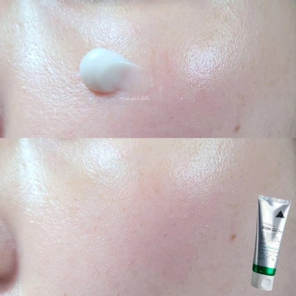 プロCICA クリアスポットパッチ/VT/その他スキンケアを使ったクチコミ(5枚目)