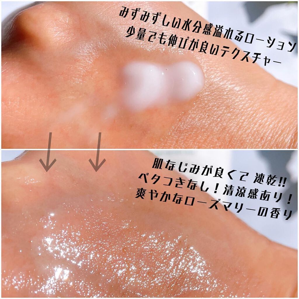 AHA.BHA.PHAミラクルカーミングボディローション /SOME BY MI/ボディローションを使ったクチコミ(5枚目)