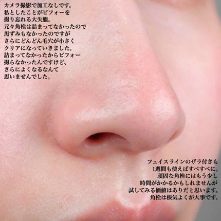 オバジC 酵素洗顔パウダー/オバジ/洗顔パウダーを使ったクチコミ(4枚目)