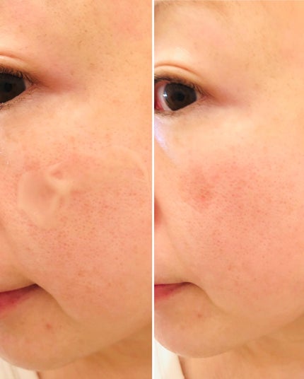 ブラックスネイルレチノールセラム/Dr.G/美容液を使ったクチコミ(6枚目)