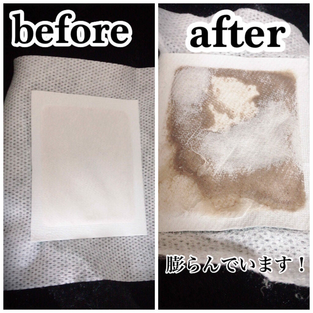 足裏樹液シート/DAISO/レッグ・フットケアを使ったクチコミ(3枚目)